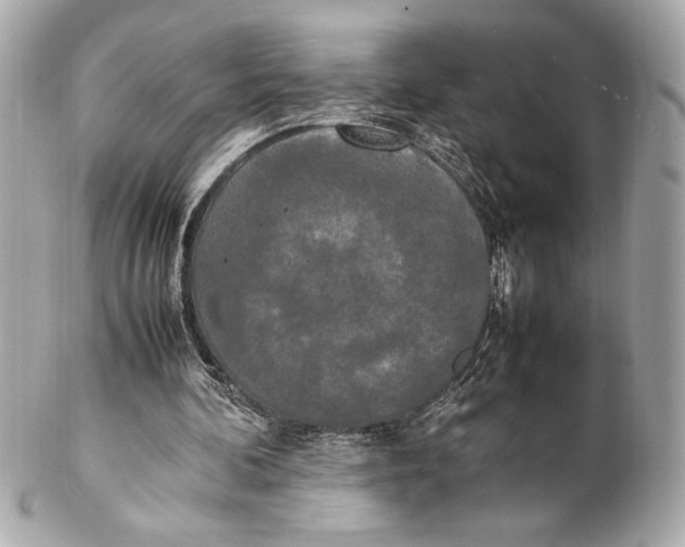 X0000102260292200808151847