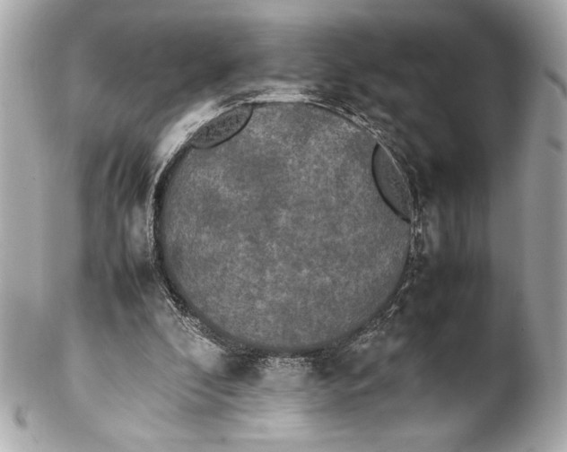 X0000102260296200808151847