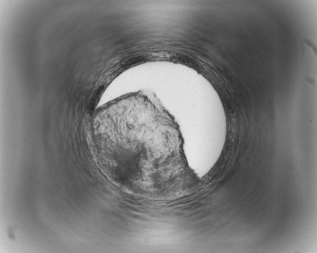 X0000102260707200808151841