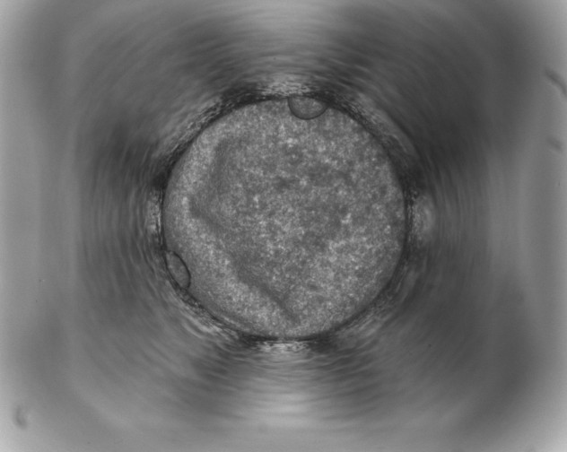 X0000102280517200808151931