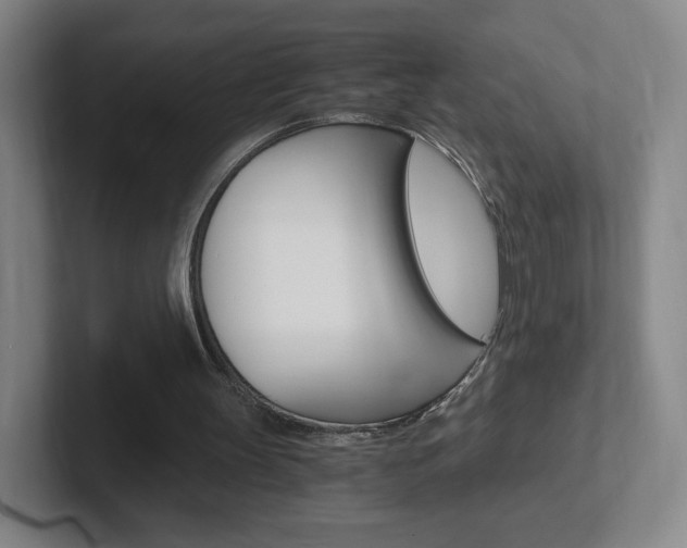 X0000102300147200807251028