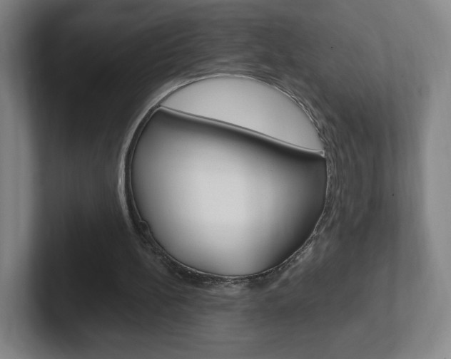 X0000102300148200807251028