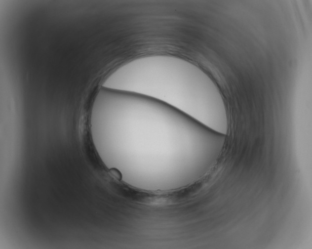 X0000102300356200807251025
