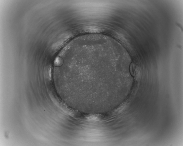 X0000102300358200808152023