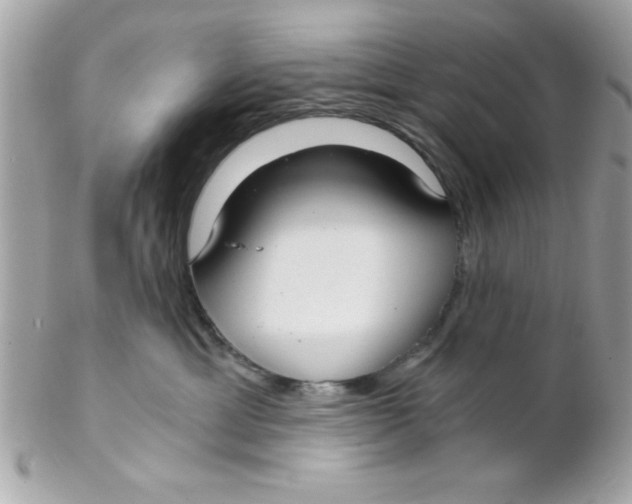 X0000102300429200808152022