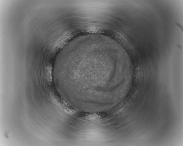 X0000102300696200808152018