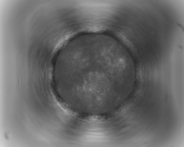 X0000102300736200808152017