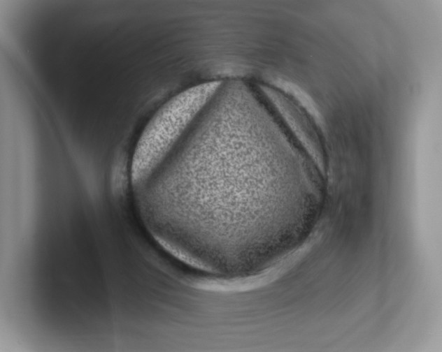 X0000102310017200808081617