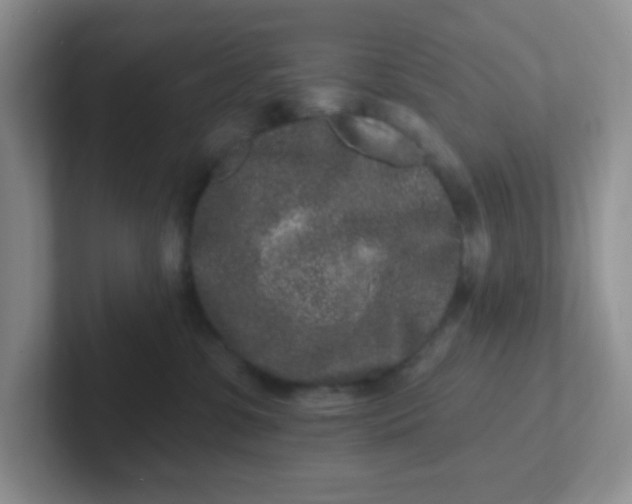 X0000102310331200808081612