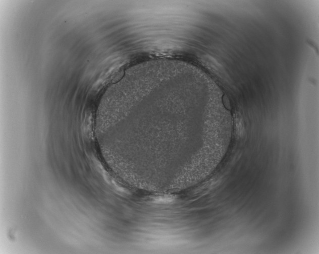 X0000102311060200808152036
