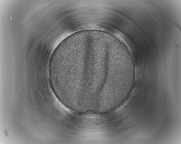 X0000102311141200808152035