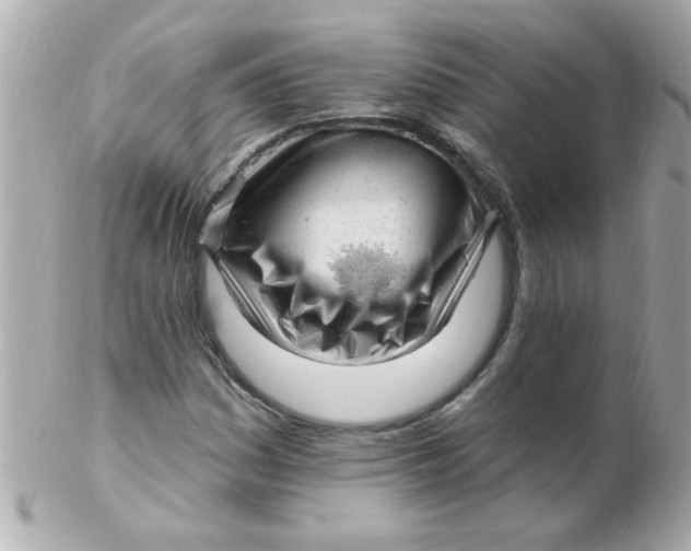 X0000102311161200808152034