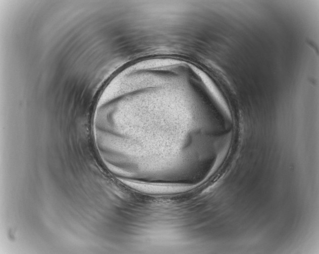 X0000102311170200808152034