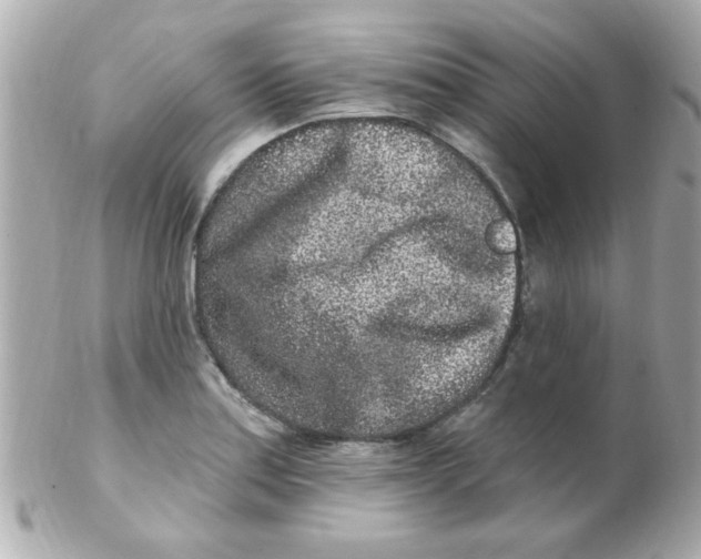 X0000102311179200808152034