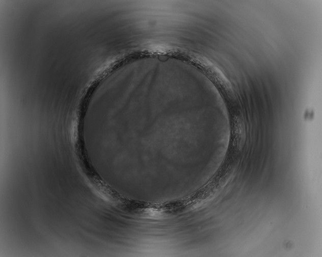 X0000102340496200808291140