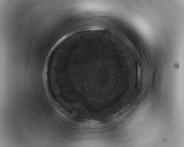 X0000102350387200808151755