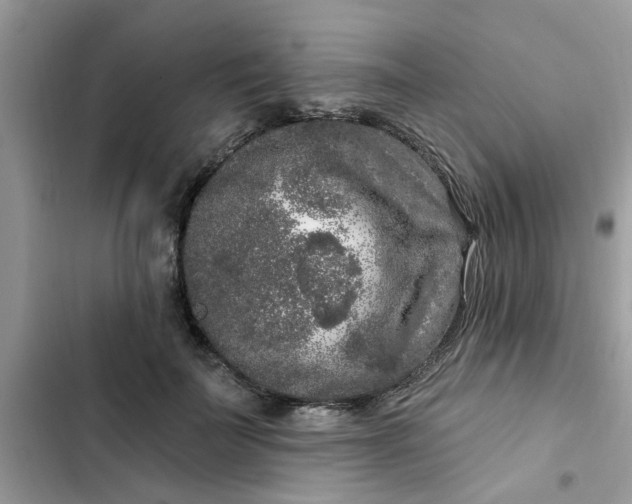 X0000102350699200808151751