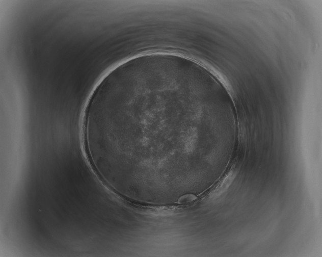 X0000102361533200808011442