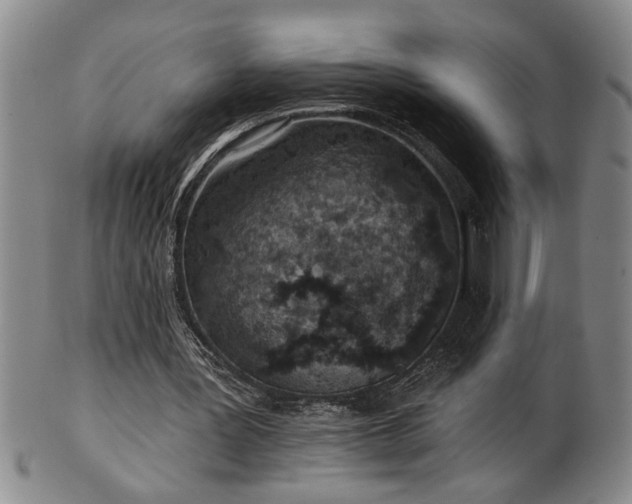 X0000102360387200808081135