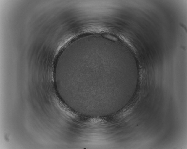 X0000102360399200808081135