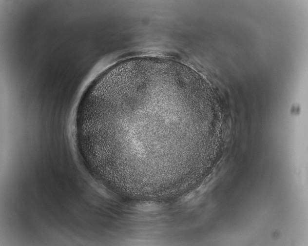 X0000102360198200808151820