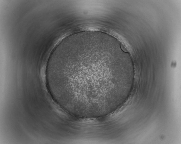 X0000102360386200808151817