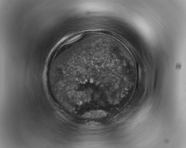 X0000102360387200808151817