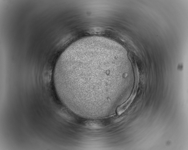 X0000102360652200808151814