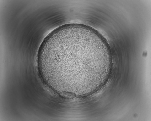 X0000102360879200808151810