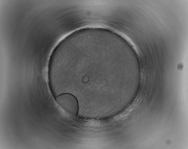 X0000102360935200808151810