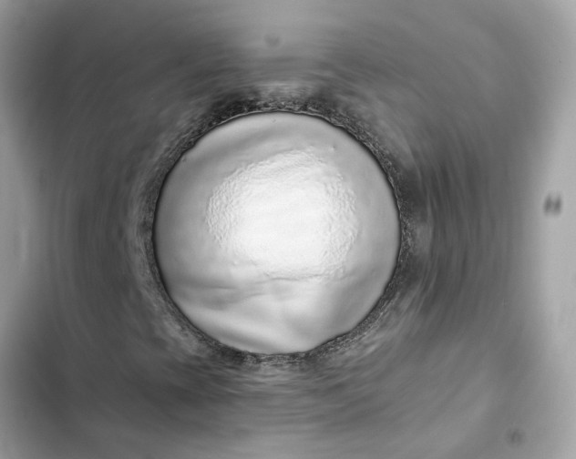 X0000102361393200808151803