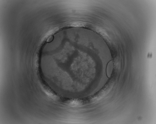 X0000102380303200808011543