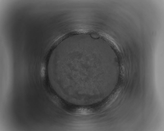 X0000102380596200808081139