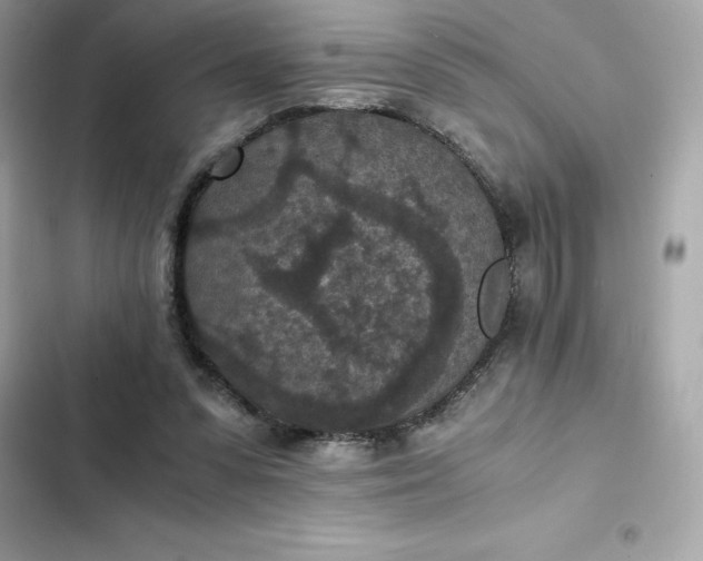 X0000102380303200808151903