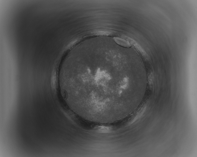 X0000102400352200808011551