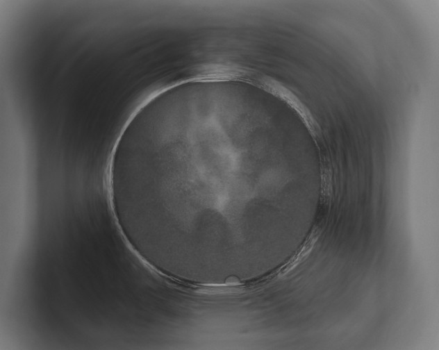 X0000102401487200808011536