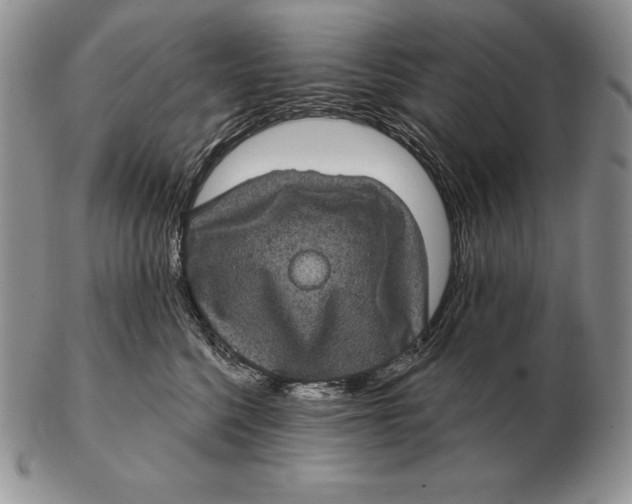 X0000102400568200808221850