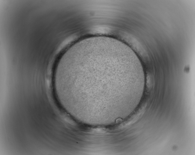 X0000102410396200808152010