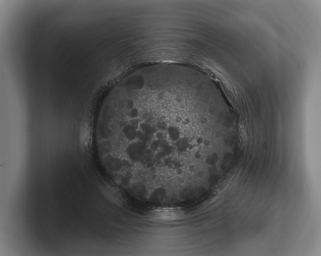 X0000102460499200808151410