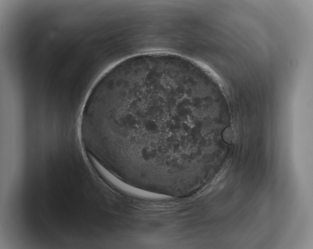 X0000102461279200808151400