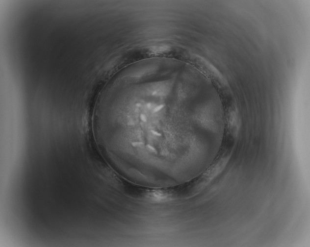 X0000102500565200808081351