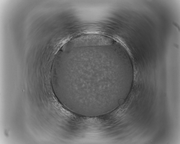 X0000102500385200808151526