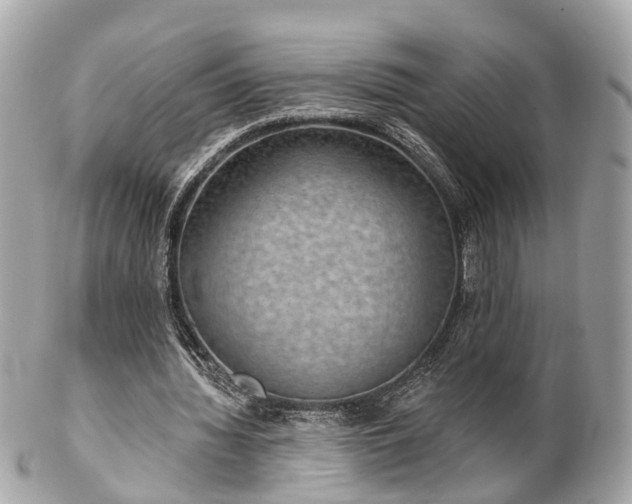 X0000102500436200808151525