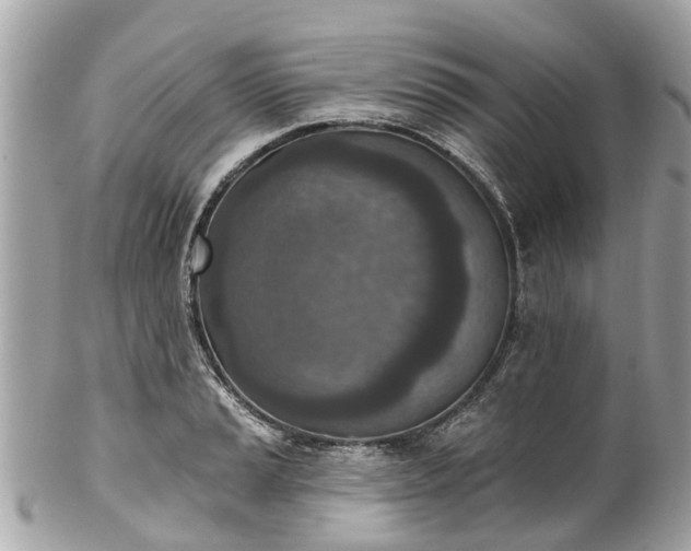 X0000102501037200808151515