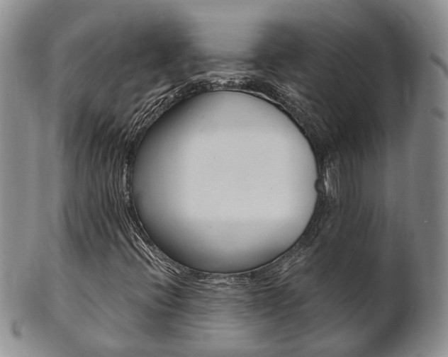 X0000102511396200808080956