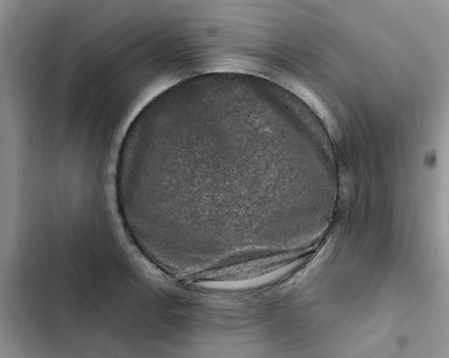 X0000102511138200808221811