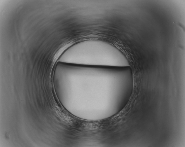 X0000102520147200808081037