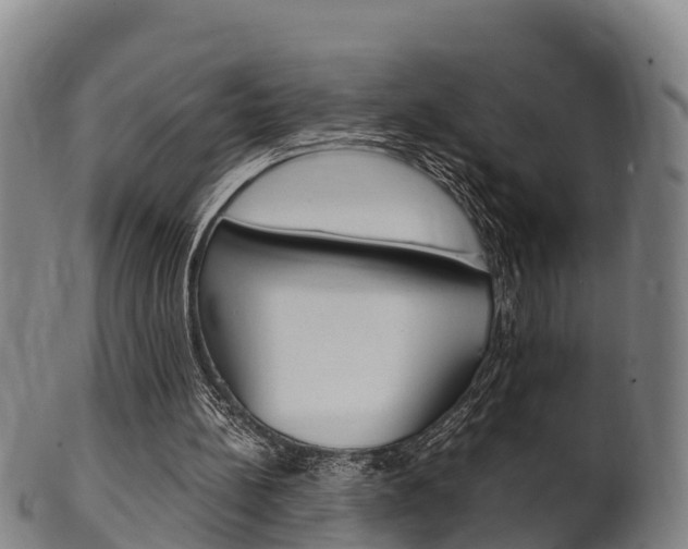 X0000102520148200808081037