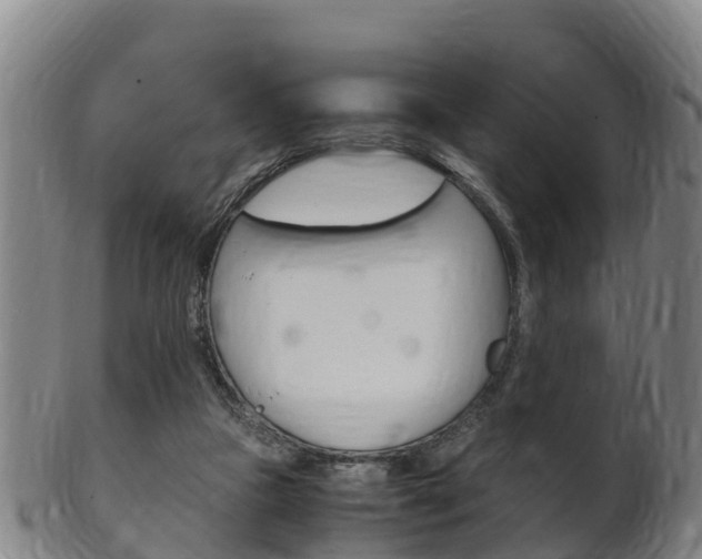 X0000102520161200808081038