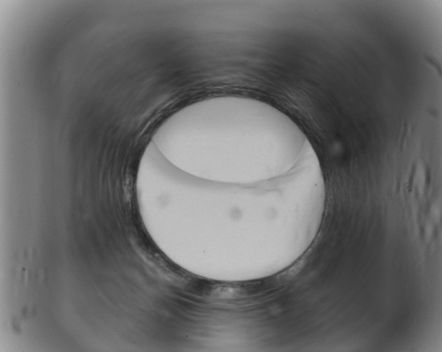 X0000102520174200808081038